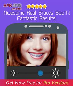braces teeth booth 2.0