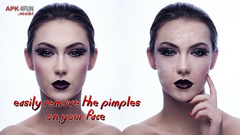 pimple remover photo editor